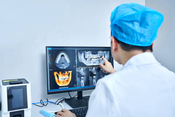 Best Dentist for Tooth Abscess  in Anacoco, LA
